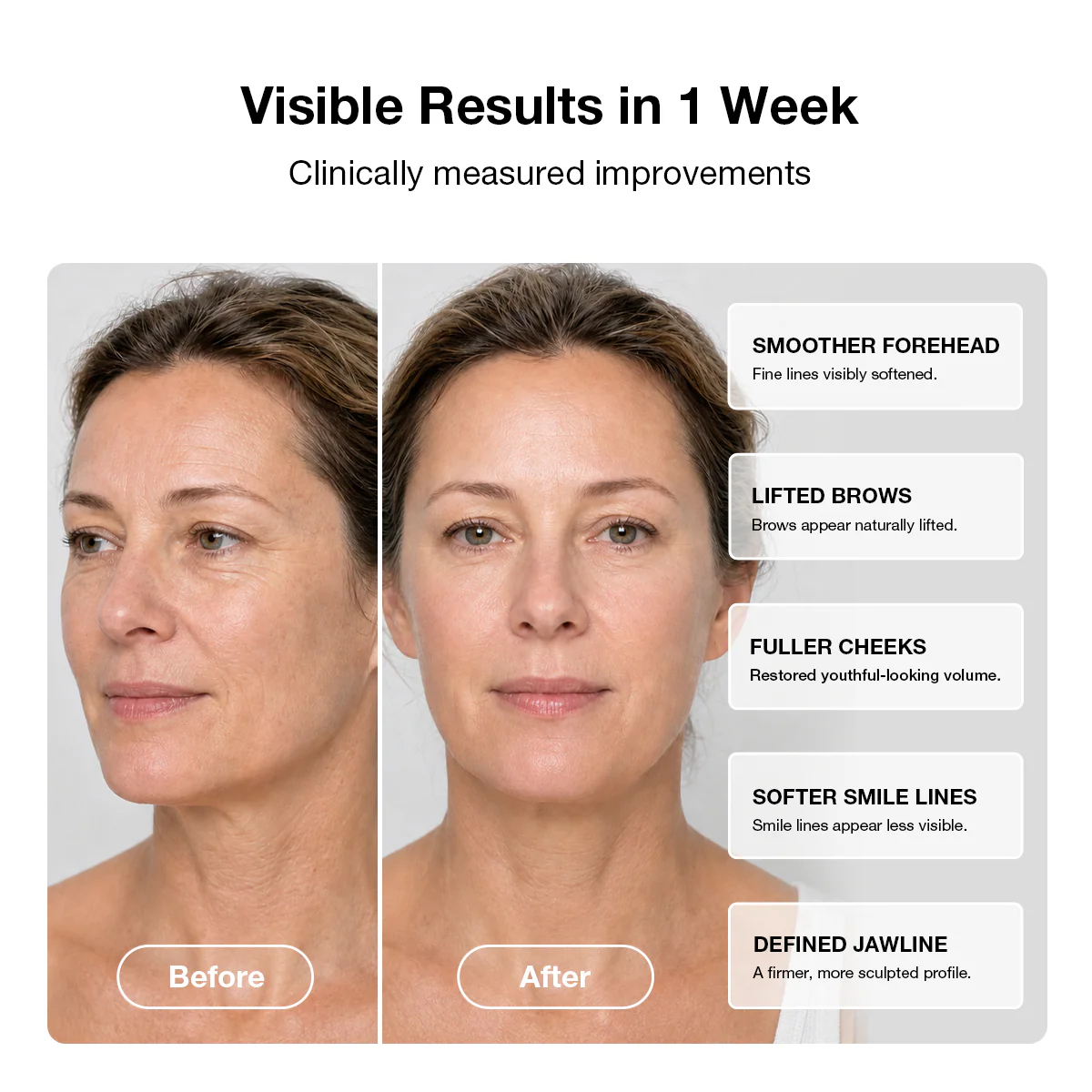 JOVS 6D Laser & EMS Anti-Aging Therapy Mask - Image 6