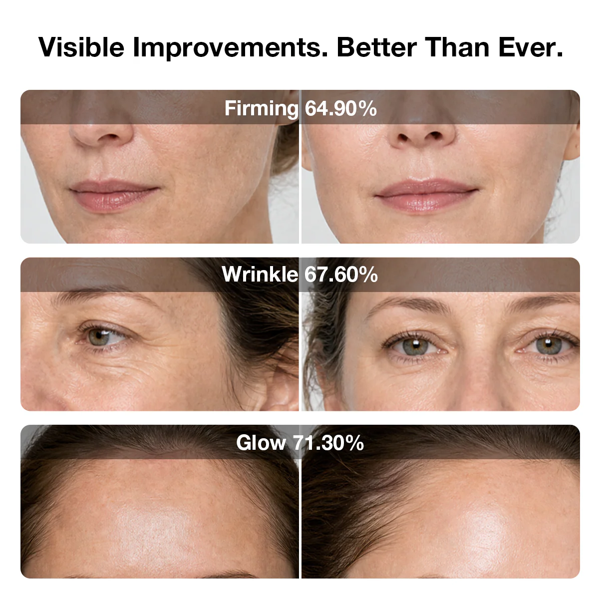 JOVS 6D Laser & EMS Anti-Aging Therapy Mask - Image 7