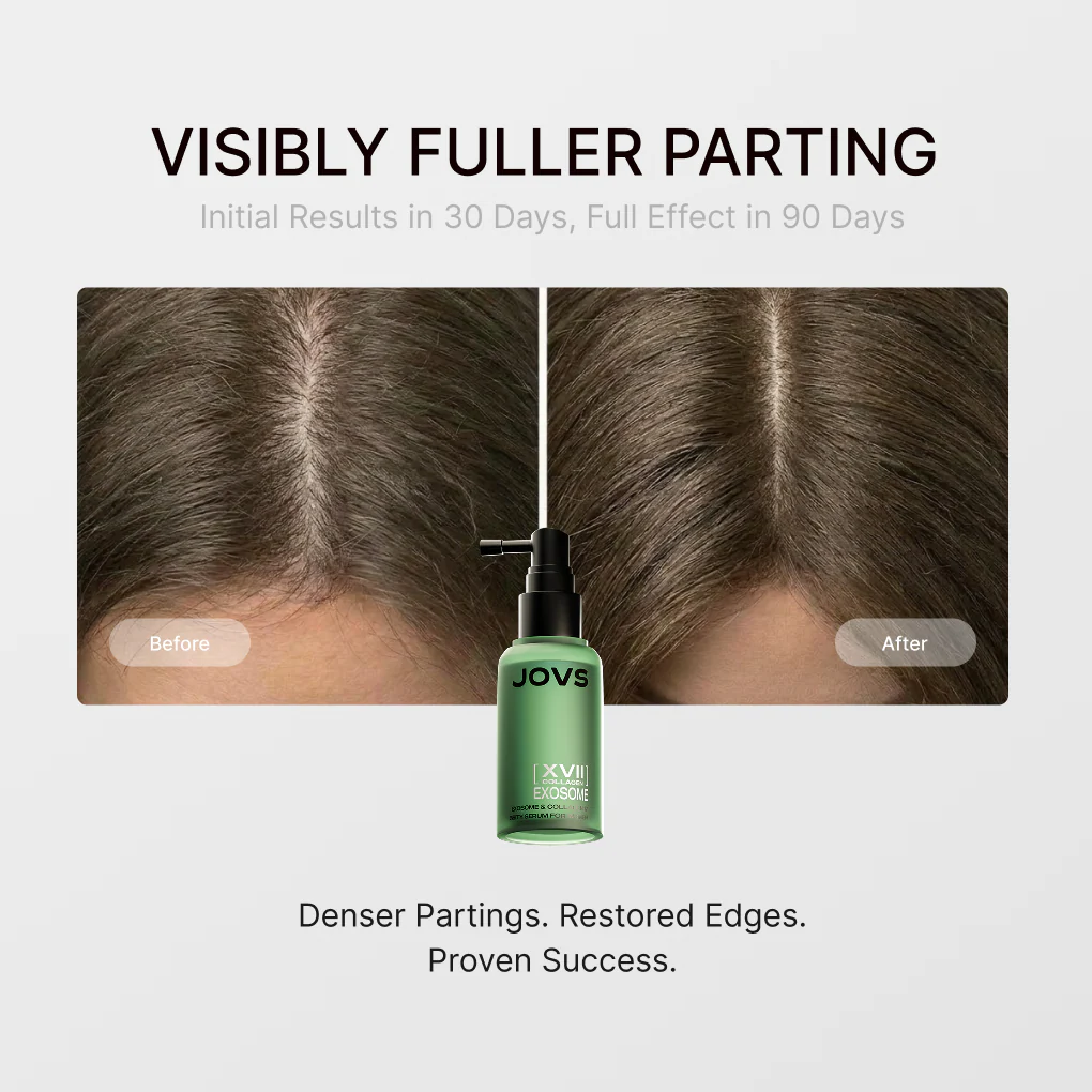 JOVS Exosome & Collagen 17 Hair Density Serum - Image 4