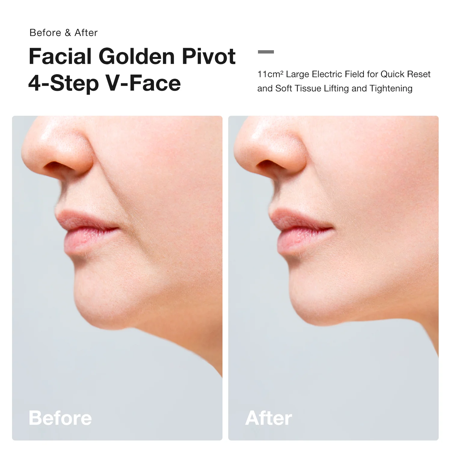 JOVS Slimax Microcurrent & Laser Light Anti-aging Device - Image 4