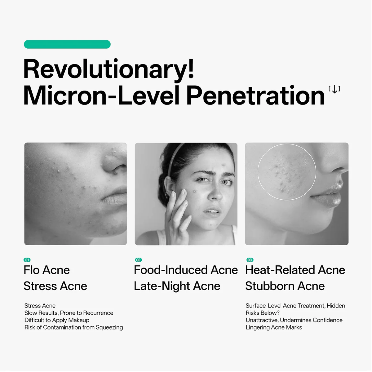 JOVS Microneedle-Infused Acne Patch - Image 5