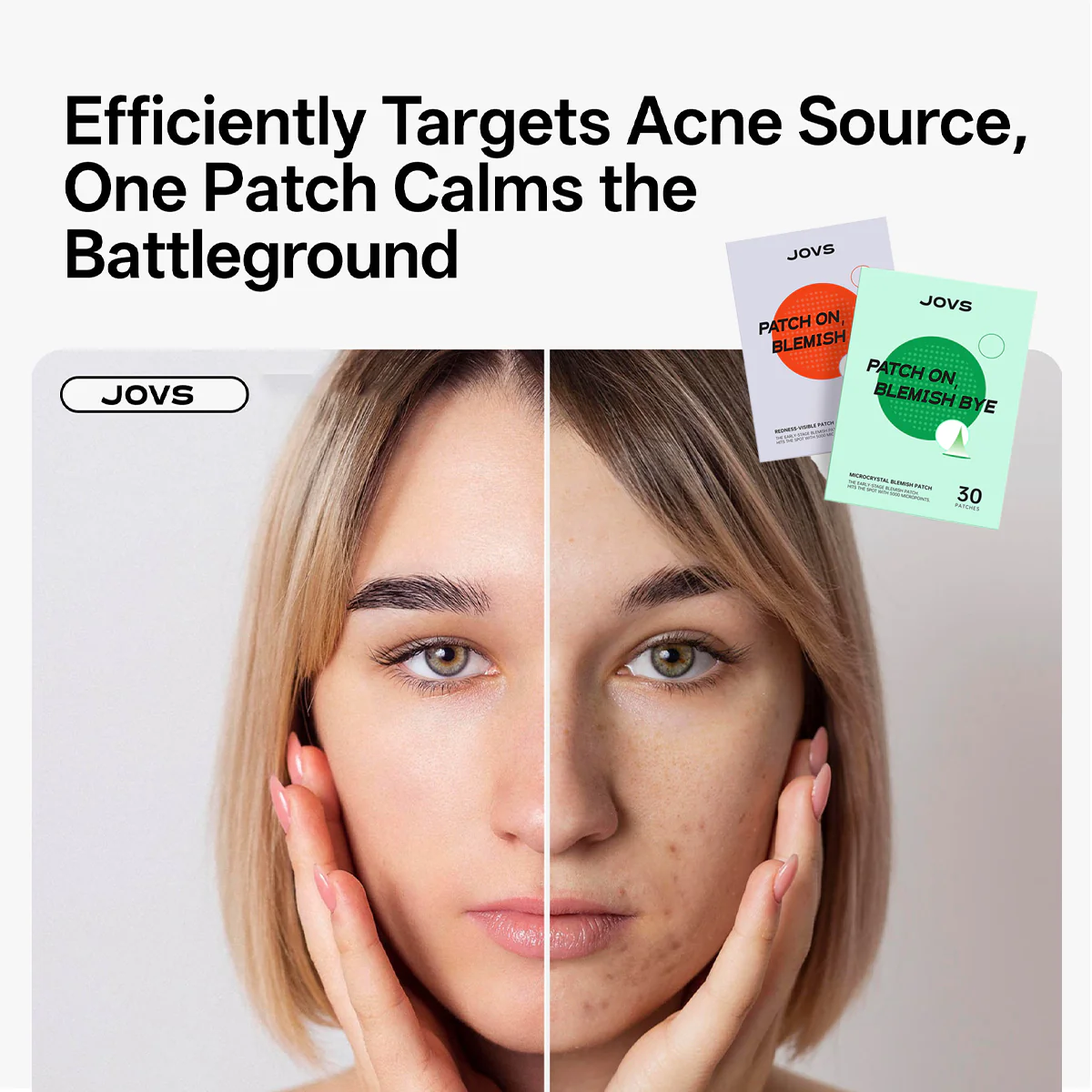 JOVS Microneedle-Infused Acne Patch - Image 8